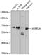 Arginine Vasopressin Receptor 1A antibody, GTX64617, GeneTex, Western Blot image 