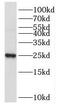 Nucleophosmin/Nucleoplasmin 3 antibody, FNab05822, FineTest, Western Blot image 