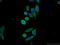 Chromosome 19 Open Reading Frame 57 antibody, 25050-1-AP, Proteintech Group, Immunofluorescence image 
