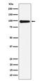 CHM Rab Escort Protein antibody, M00814, Boster Biological Technology, Western Blot image 