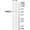 WASP Family Member 3 antibody, A06140, Boster Biological Technology, Western Blot image 