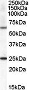 Collagen type IV alpha-3-binding protein antibody, orb19732, Biorbyt, Western Blot image 