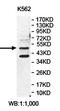 Ectonucleotide Pyrophosphatase/Phosphodiesterase 6 antibody, orb78305, Biorbyt, Western Blot image 