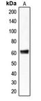 Chloride Channel CLIC Like 1 antibody, LS-C353335, Lifespan Biosciences, Western Blot image 
