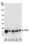 Ribosomal Protein S11 antibody, NBP2-22289, Novus Biologicals, Western Blot image 