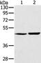 SEC14 Like Lipid Binding 2 antibody, PA5-50751, Invitrogen Antibodies, Western Blot image 