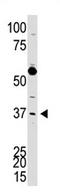 Dickkopf WNT Signaling Pathway Inhibitor 3 antibody, AP11554PU-N, Origene, Western Blot image 