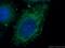 Mitochondrial Ribosomal Protein S21 antibody, 16359-1-AP, Proteintech Group, Immunofluorescence image 