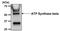 ATP Synthase F1 Subunit Beta antibody, NB600-1171, Novus Biologicals, Immunoprecipitation image 