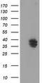 V-Set And Immunoglobulin Domain Containing 2 antibody, TA502108, Origene, Western Blot image 