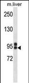 ATP Binding Cassette Subfamily C Member 12 antibody, PA5-48527, Invitrogen Antibodies, Western Blot image 