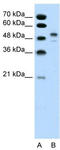 POU domain, class 3, transcription factor 2 antibody, TA329222, Origene, Western Blot image 