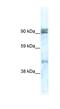 Zinc Finger Protein 227 antibody, NBP1-80193, Novus Biologicals, Western Blot image 