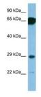 Small Nuclear Ribonucleoprotein Polypeptide N antibody, NBP1-74239, Novus Biologicals, Western Blot image 