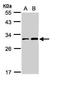 TP53 Induced Glycolysis Regulatory Phosphatase antibody, GTX110514, GeneTex, Western Blot image 
