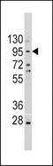 Cadherin 1 antibody, TA302228, Origene, Western Blot image 