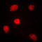 Mediator of RNA polymerase II transcription subunit 1 antibody, LS-B14558, Lifespan Biosciences, Immunofluorescence image 