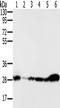 NADH:Ubiquinone Oxidoreductase Core Subunit S3 antibody, TA350215, Origene, Western Blot image 