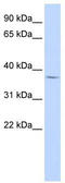 Forkhead box protein B1 antibody, TA339453, Origene, Western Blot image 