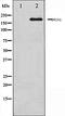 Cell Division Cycle 25B antibody, orb106412, Biorbyt, Western Blot image 