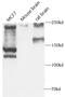 ALK Receptor Tyrosine Kinase antibody, FNab00309, FineTest, Western Blot image 