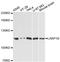 La Ribonucleoprotein Domain Family Member 1B antibody, A13222, ABclonal Technology, Western Blot image 