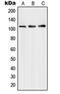 PMS1 Homolog 1, Mismatch Repair System Component antibody, orb214411, Biorbyt, Western Blot image 