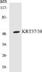 Keratin 37 antibody, EKC1332, Boster Biological Technology, Western Blot image 
