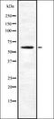 Coenzyme A Synthase antibody, orb337617, Biorbyt, Western Blot image 