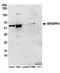 Golgi reassembly-stacking protein 1 antibody, A304-563A, Bethyl Labs, Western Blot image 