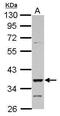 Doublesex And Mab-3 Related Transcription Factor 1 antibody, PA5-28331, Invitrogen Antibodies, Western Blot image 