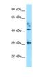 ATCAY Kinesin Light Chain Interacting Caytaxin antibody, orb326375, Biorbyt, Western Blot image 