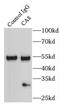 Carbonic Anhydrase 8 antibody, FNab01166, FineTest, Immunoprecipitation image 