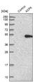 Lpap antibody, NBP1-89272, Novus Biologicals, Western Blot image 