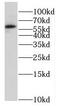 Heat Shock Factor Binding Protein 1 antibody, FNab04018, FineTest, Western Blot image 