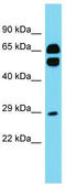 Cell surface glycoprotein CD200 receptor 2 antibody, TA334866, Origene, Western Blot image 