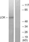 Proto-oncogene tyrosine-protein kinase LCK antibody, LS-C118171, Lifespan Biosciences, Western Blot image 