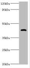 Zonulin antibody, A55503-100, Epigentek, Western Blot image 