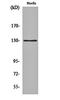 5-azacytidine-induced protein 1 antibody, orb160076, Biorbyt, Western Blot image 