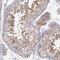 Endoplasmic reticulum-Golgi intermediate compartment protein 2 antibody, NBP2-56121, Novus Biologicals, Immunohistochemistry paraffin image 