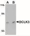 Doublecortin Like Kinase 3 antibody, NBP1-77129, Novus Biologicals, Western Blot image 