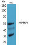 HSPB1 Associated Protein 1 antibody, STJ96504, St John