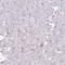 Carbonic anhydrase 3 antibody, HPA026700, Atlas Antibodies, Immunohistochemistry frozen image 