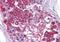 Solute Carrier Family 39 Member 3 antibody, orb94601, Biorbyt, Immunohistochemistry paraffin image 