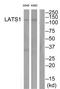 WARTS antibody, TA314859, Origene, Western Blot image 