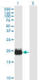 Intraflagellar Transport 20 antibody, LS-C139316, Lifespan Biosciences, Western Blot image 