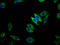 Transient Receptor Potential Cation Channel Subfamily M Member 1 antibody, LS-C681608, Lifespan Biosciences, Immunofluorescence image 