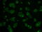 Hexokinase 2 antibody, GTX84357, GeneTex, Immunofluorescence image 
