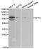 Receptor-interacting serine/threonine-protein kinase 2 antibody, TA332524, Origene, Western Blot image 