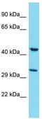 Myb/SANT DNA Binding Domain Containing 4 With Coiled-Coils antibody, TA337390, Origene, Western Blot image 